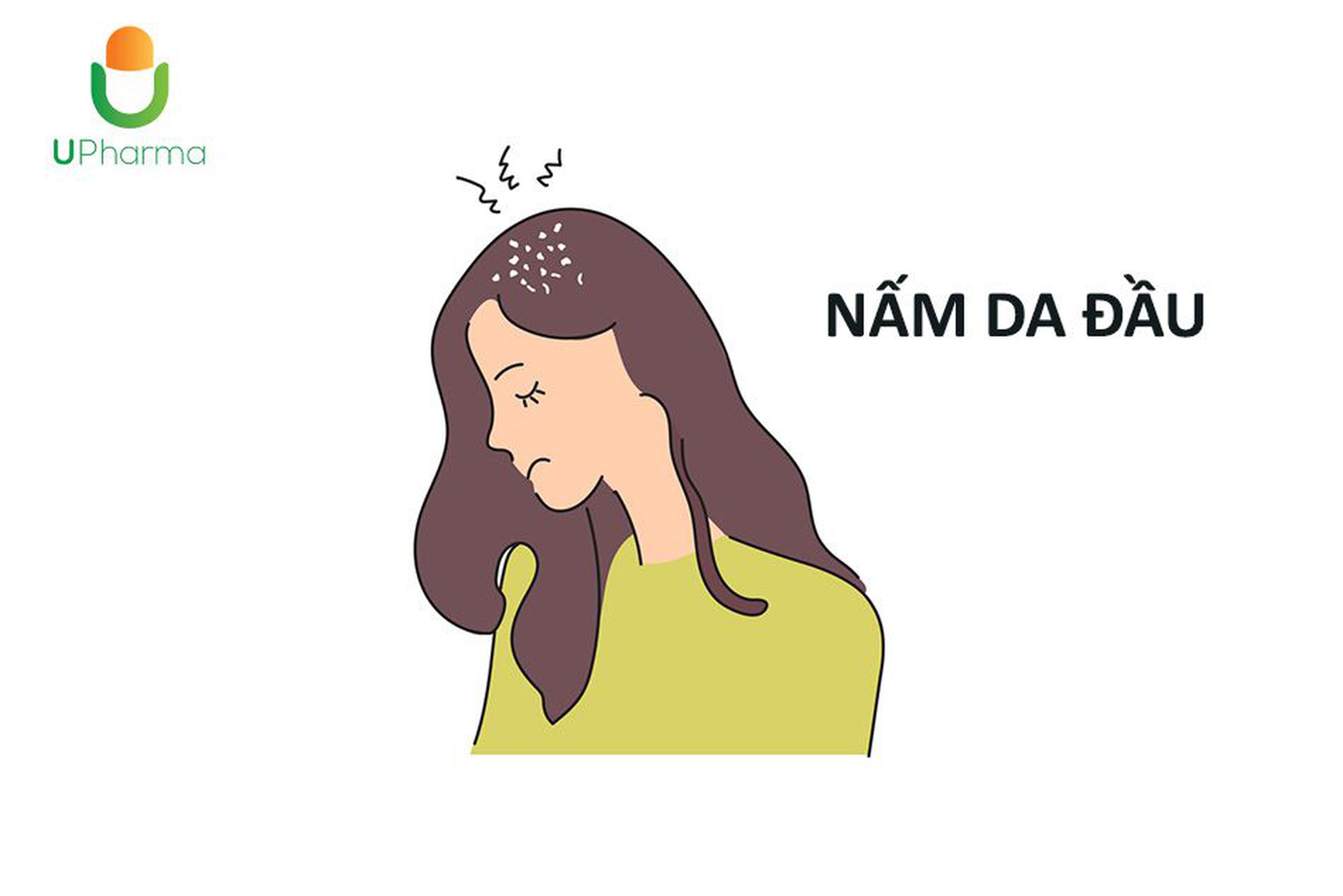 Nấm da đầu: Nguyên nhân, biểu hiện, cách điều trị.