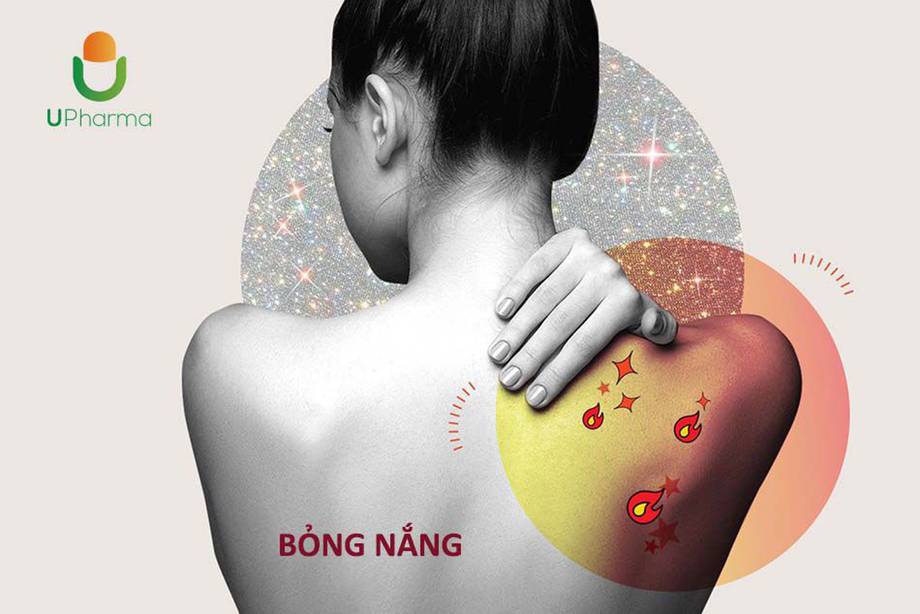 Bỏng nắng: Triệu chứng, cách xử trí và phòng ngừa.