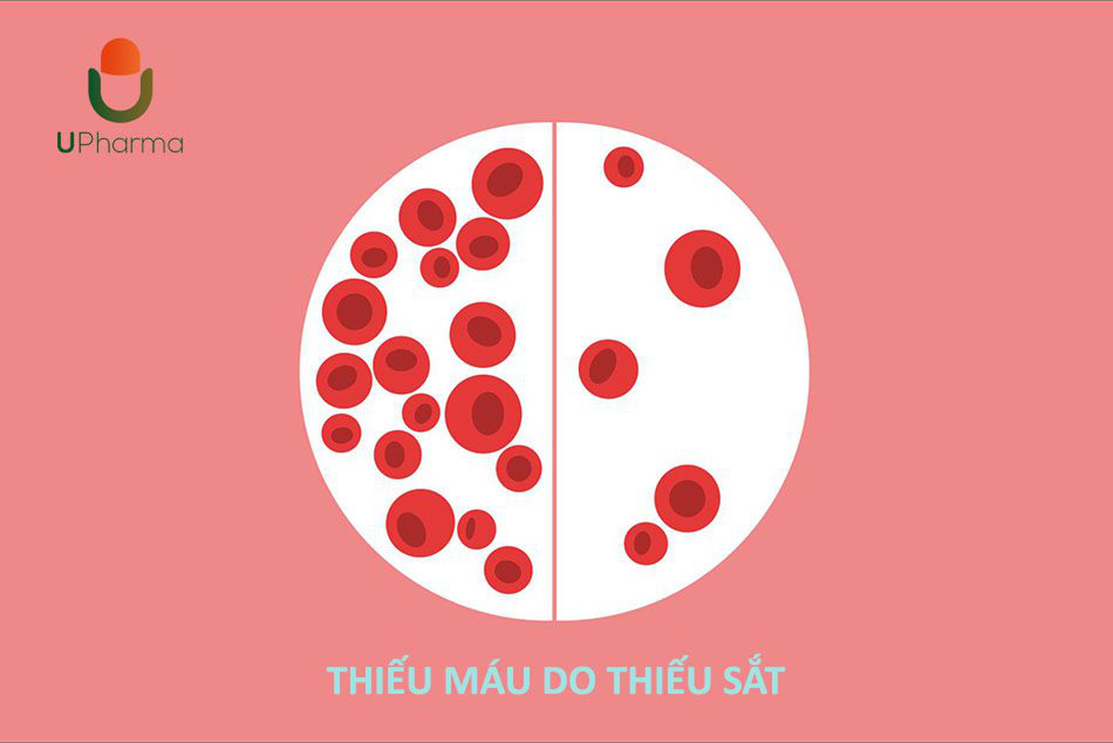 Thiếu máu do thiếu sắt: Dấu hiệu nhận biết, cách phòng tránh và điều trị.
