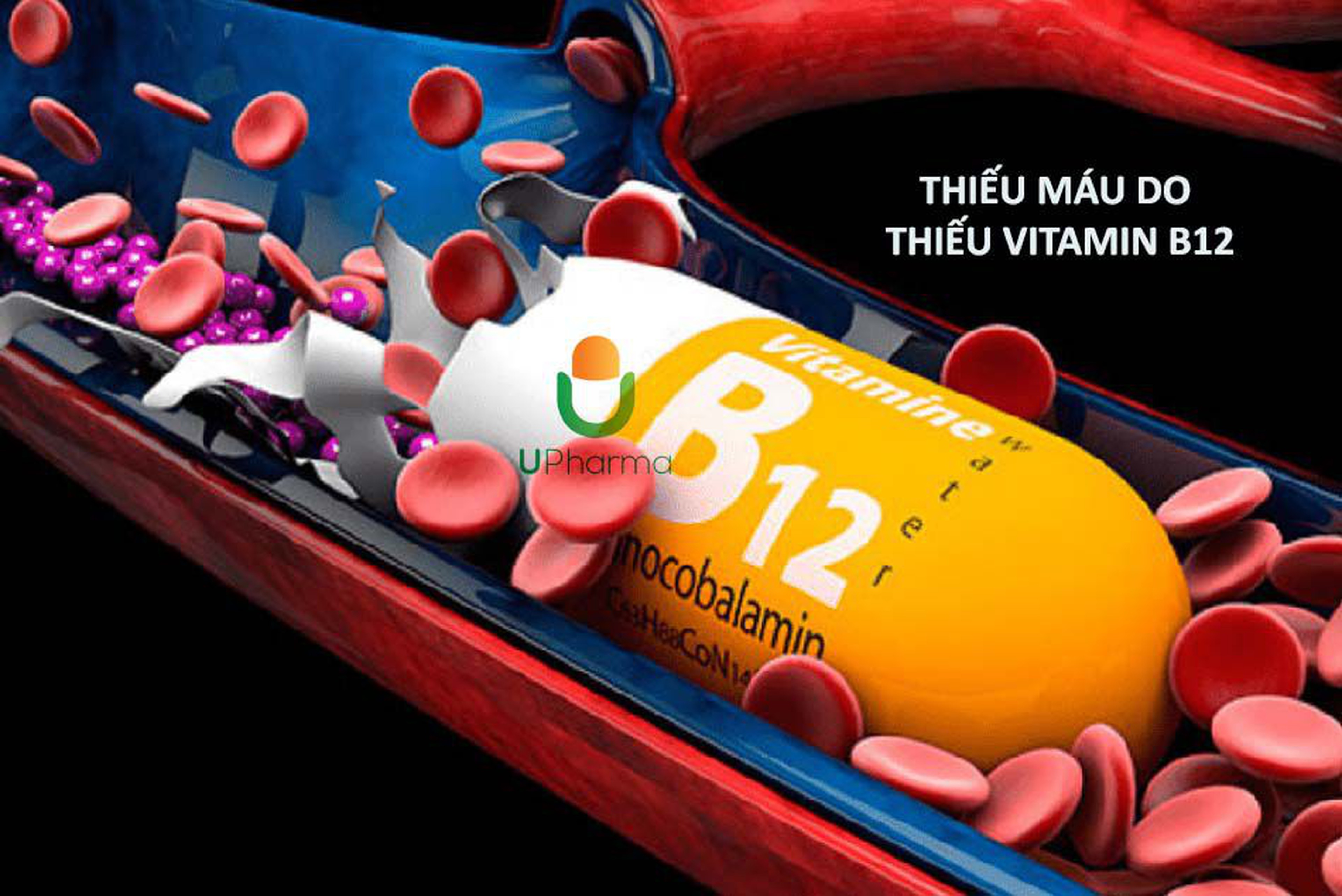 Thiếu máu do thiếu vitamin B12 là bệnh gì? Nguyên nhân, triệu chứng và cách điều trị bệnh.
