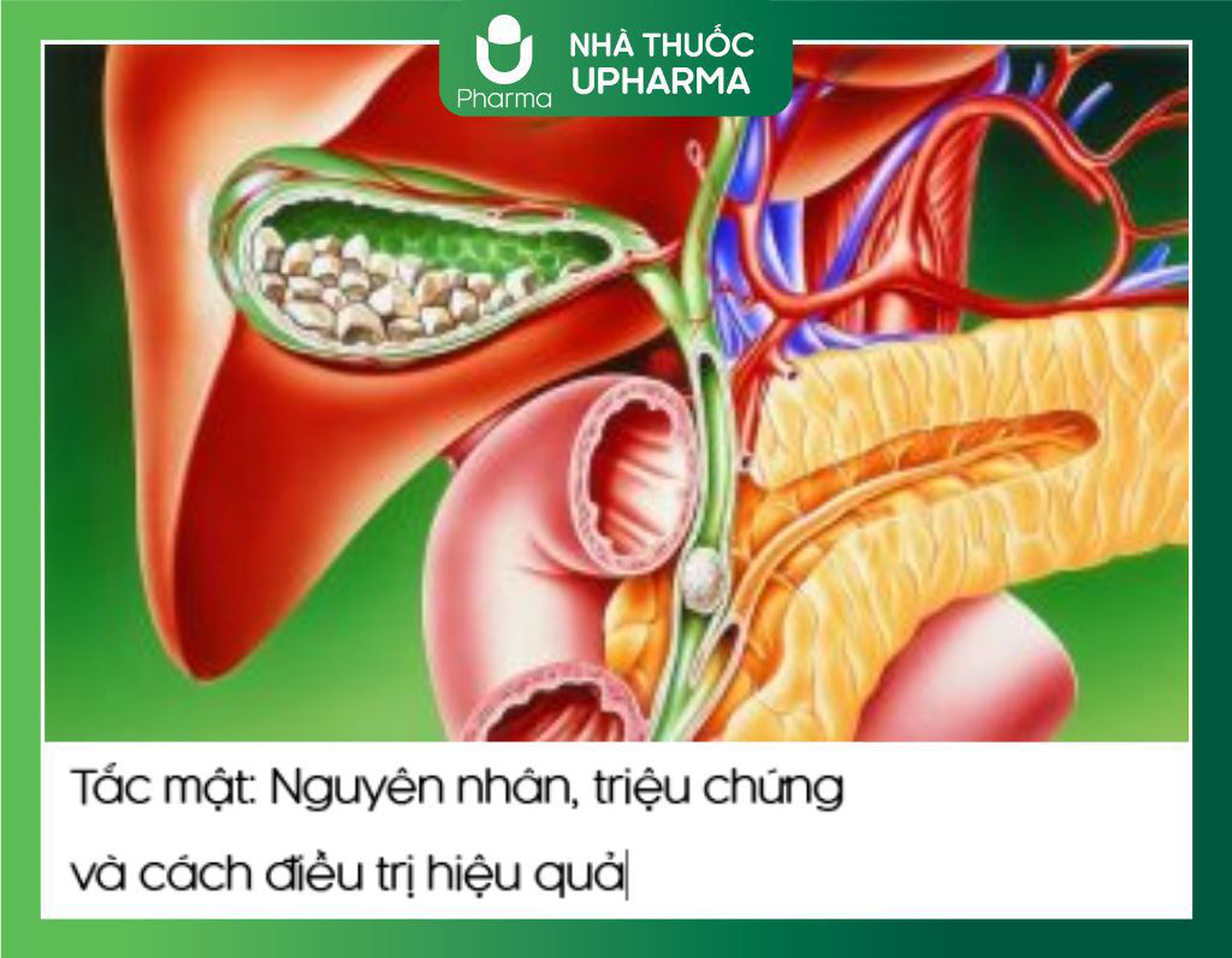 Tắc mật: Triệu chứng và cách điều trị hiệu quả