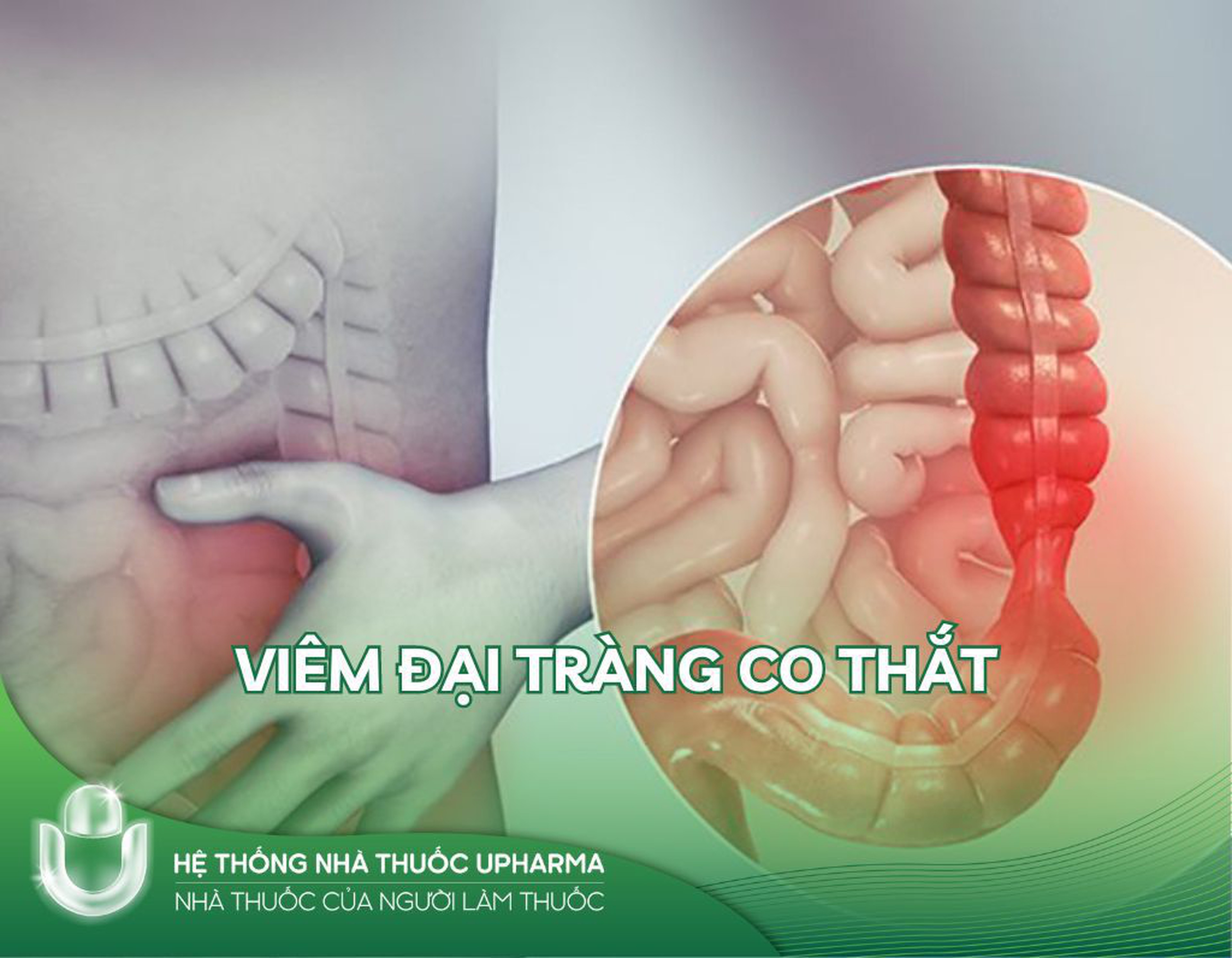 Viêm đại tràng co thắt - Nguyên nhân, triệu chứng, đối tượng và phương pháp điều trị