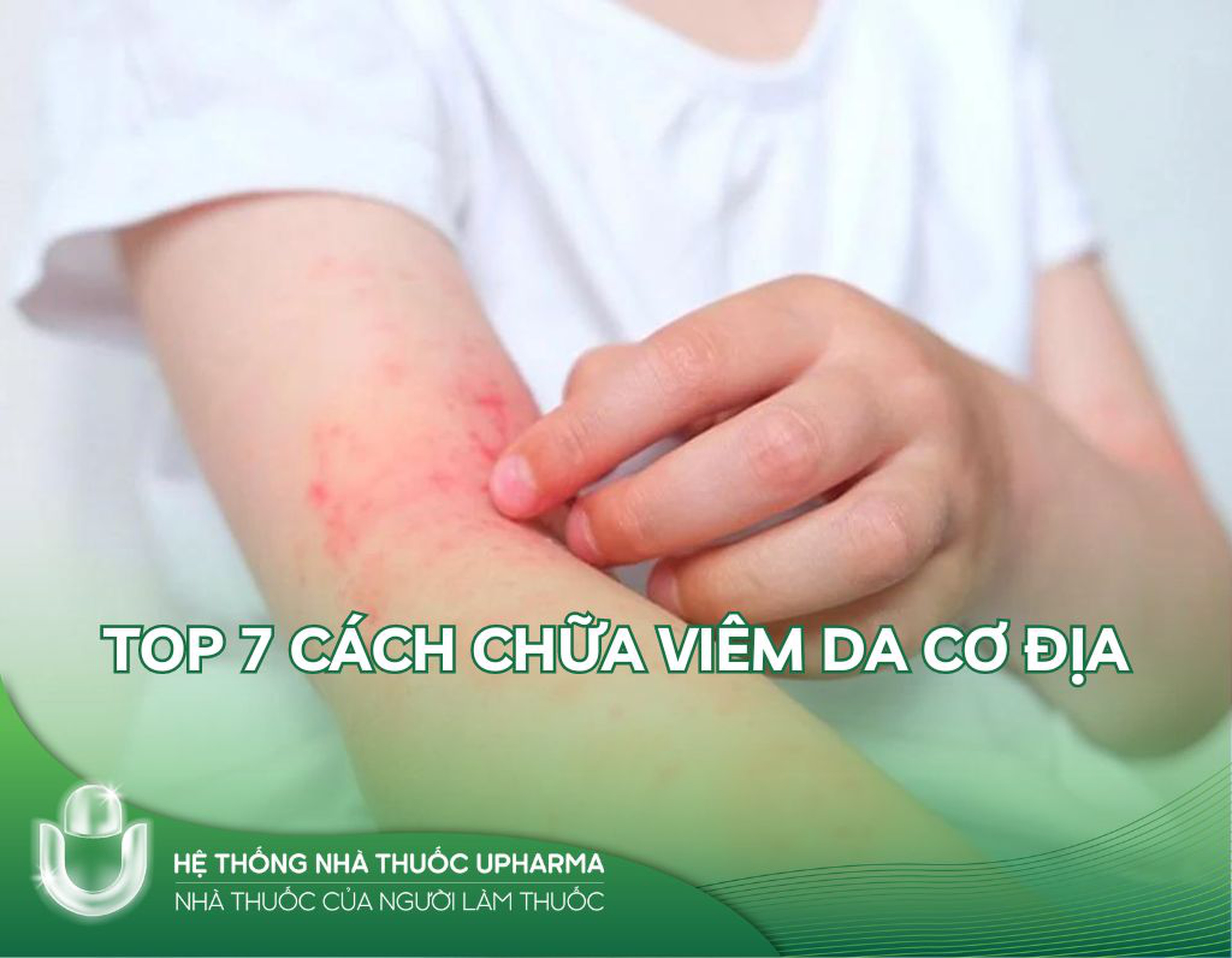 Top 7 cách chữa viêm da cơ địa dứt điểm tại nhà