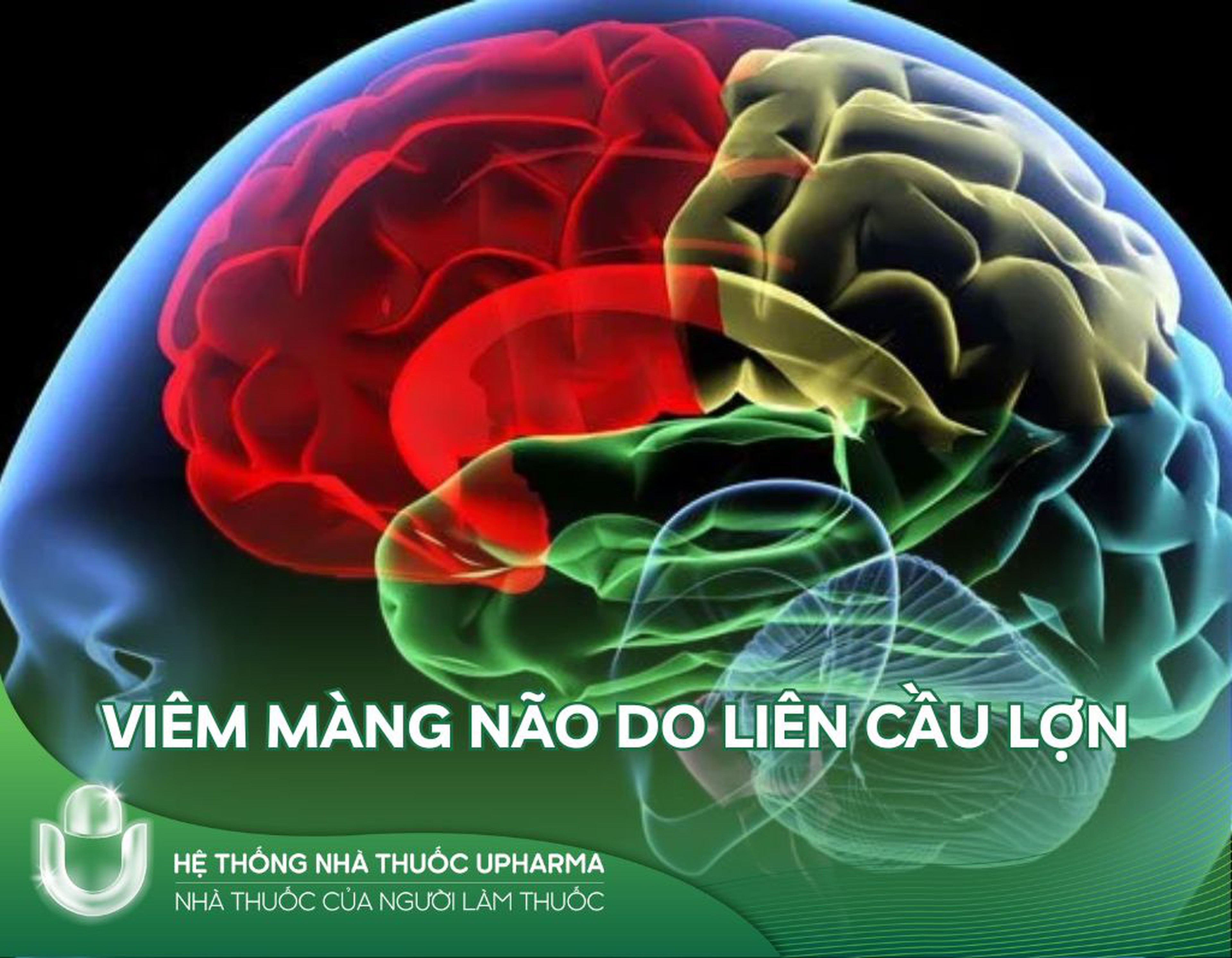 Viêm màng não do liên cầu lợn là bệnh gì?