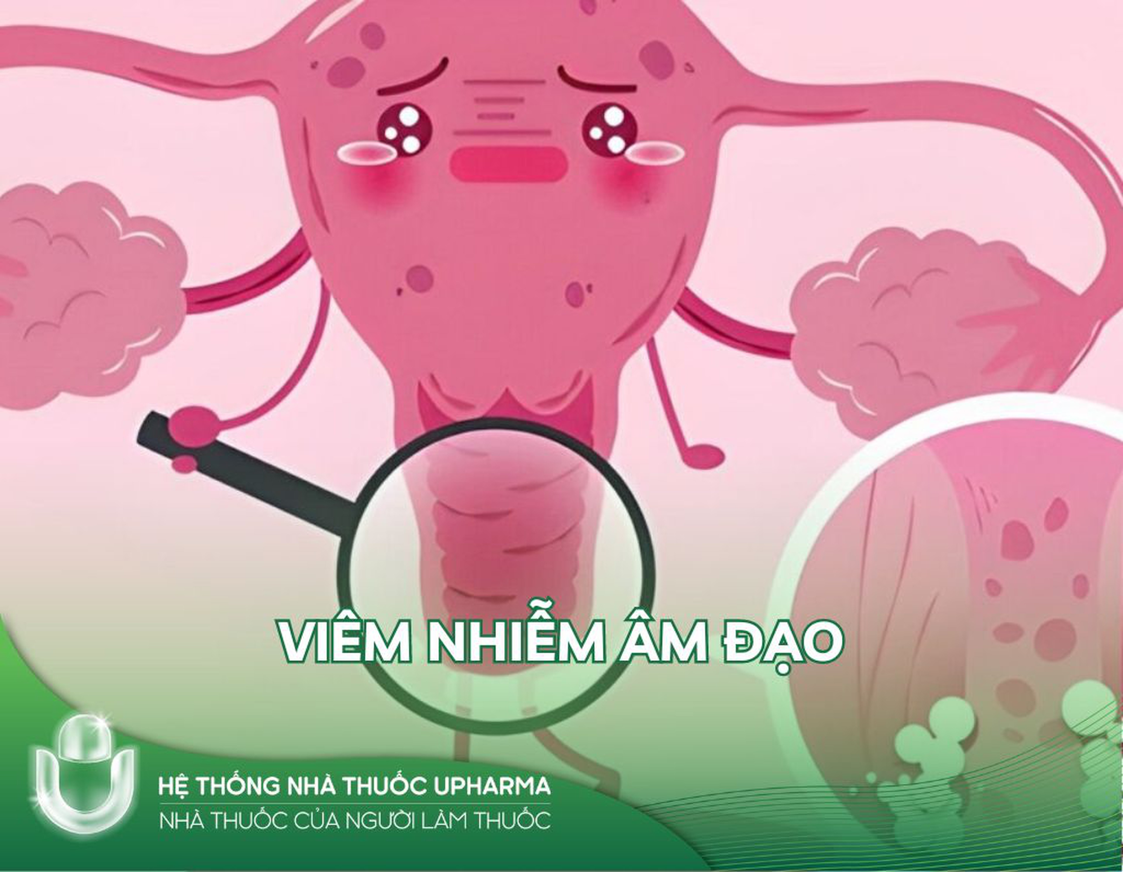 Chấm dứt Đau Rát! Giải pháp hiệu quả trị viêm nhiễm âm đạo ngay