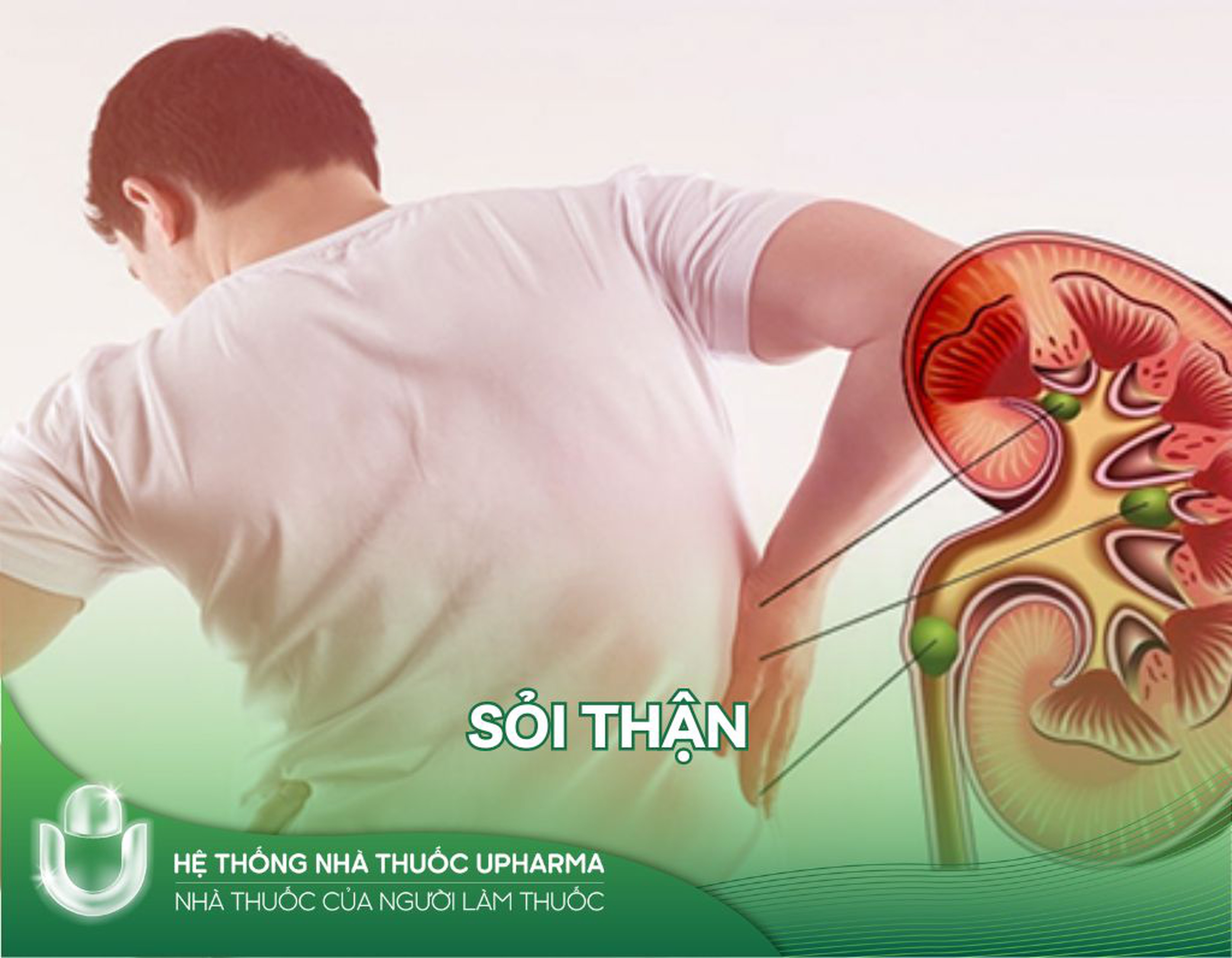 Sỏi thận có nguy hiểm không? Triệu chứng và cách điều trị