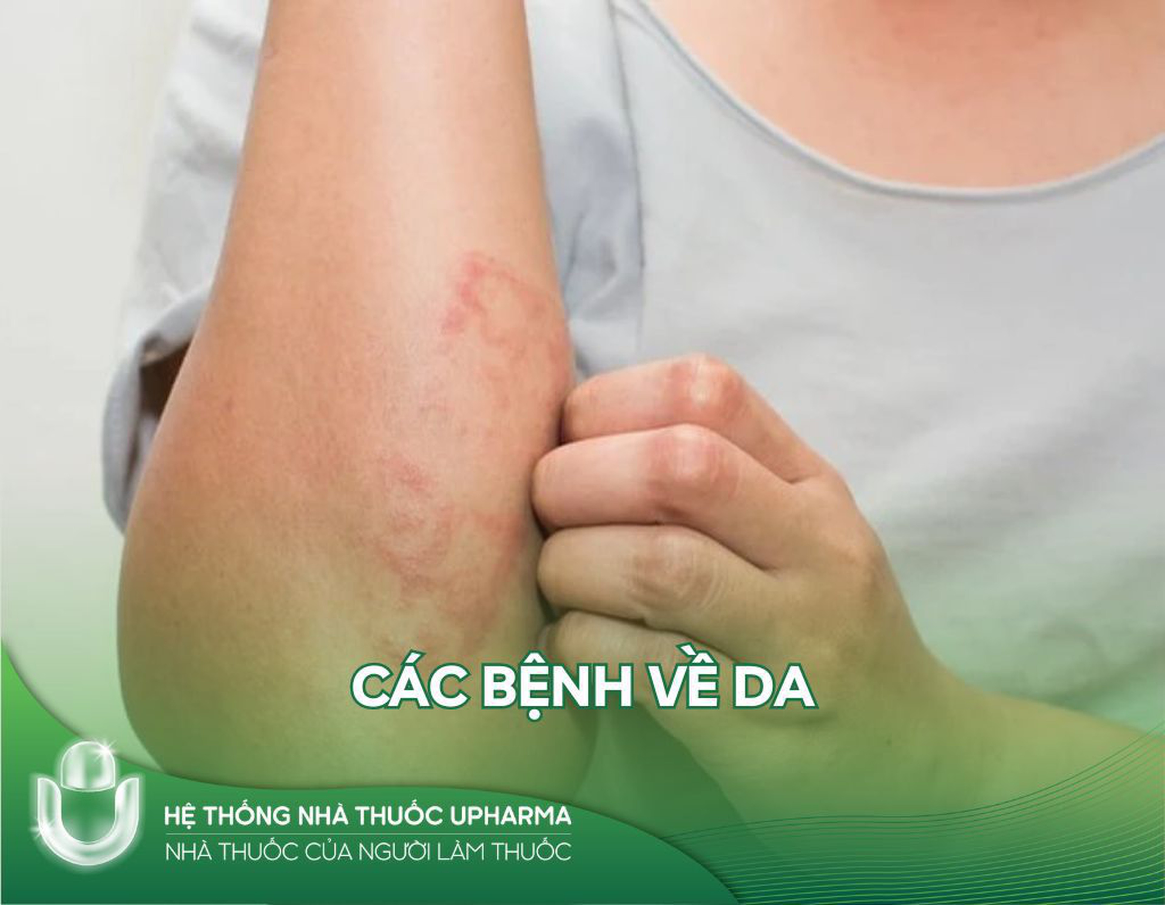 Các bệnh về da gia tăng mùa nắng nóng