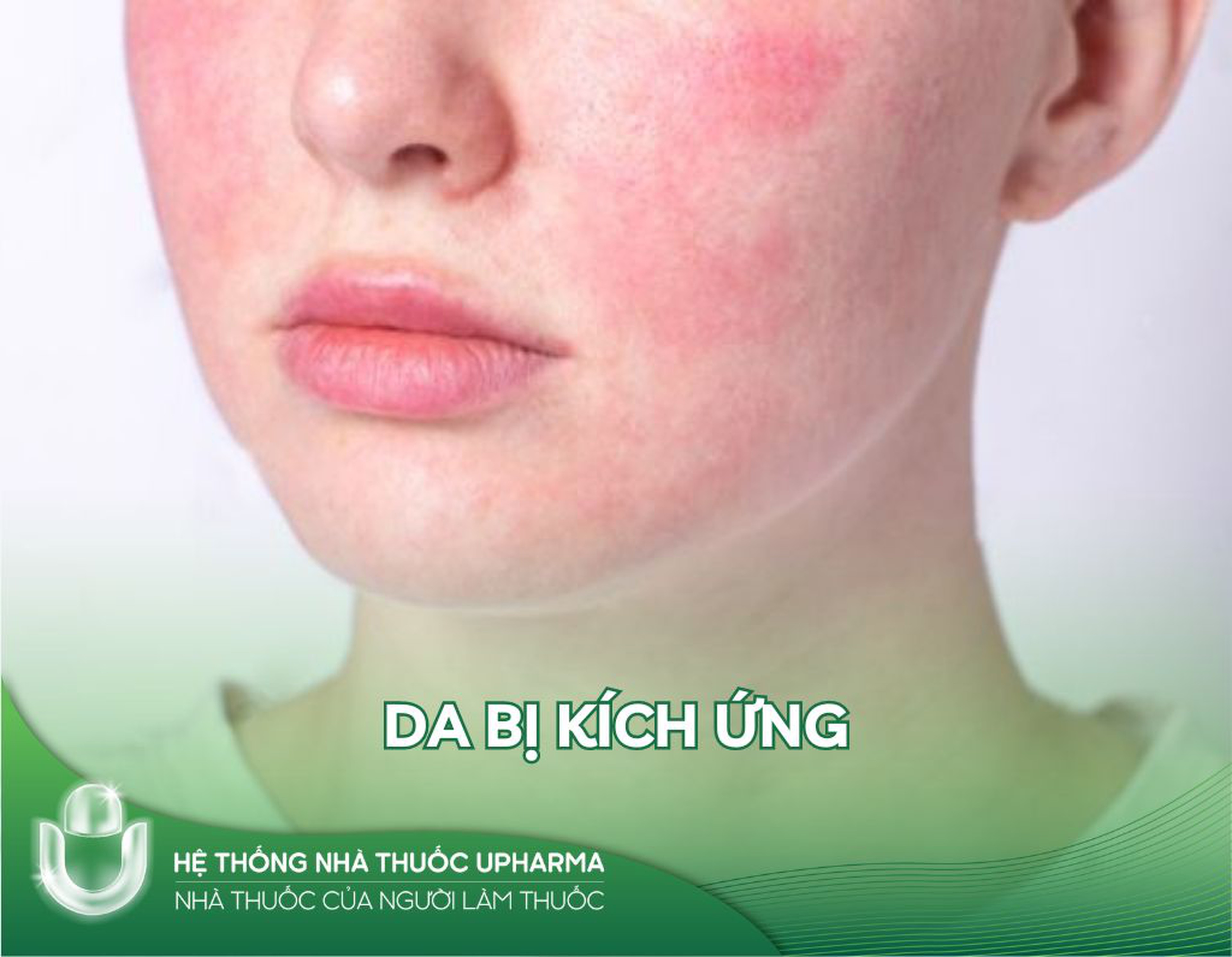 Chăm sóc da bị kích ứng do sử dụng treatment