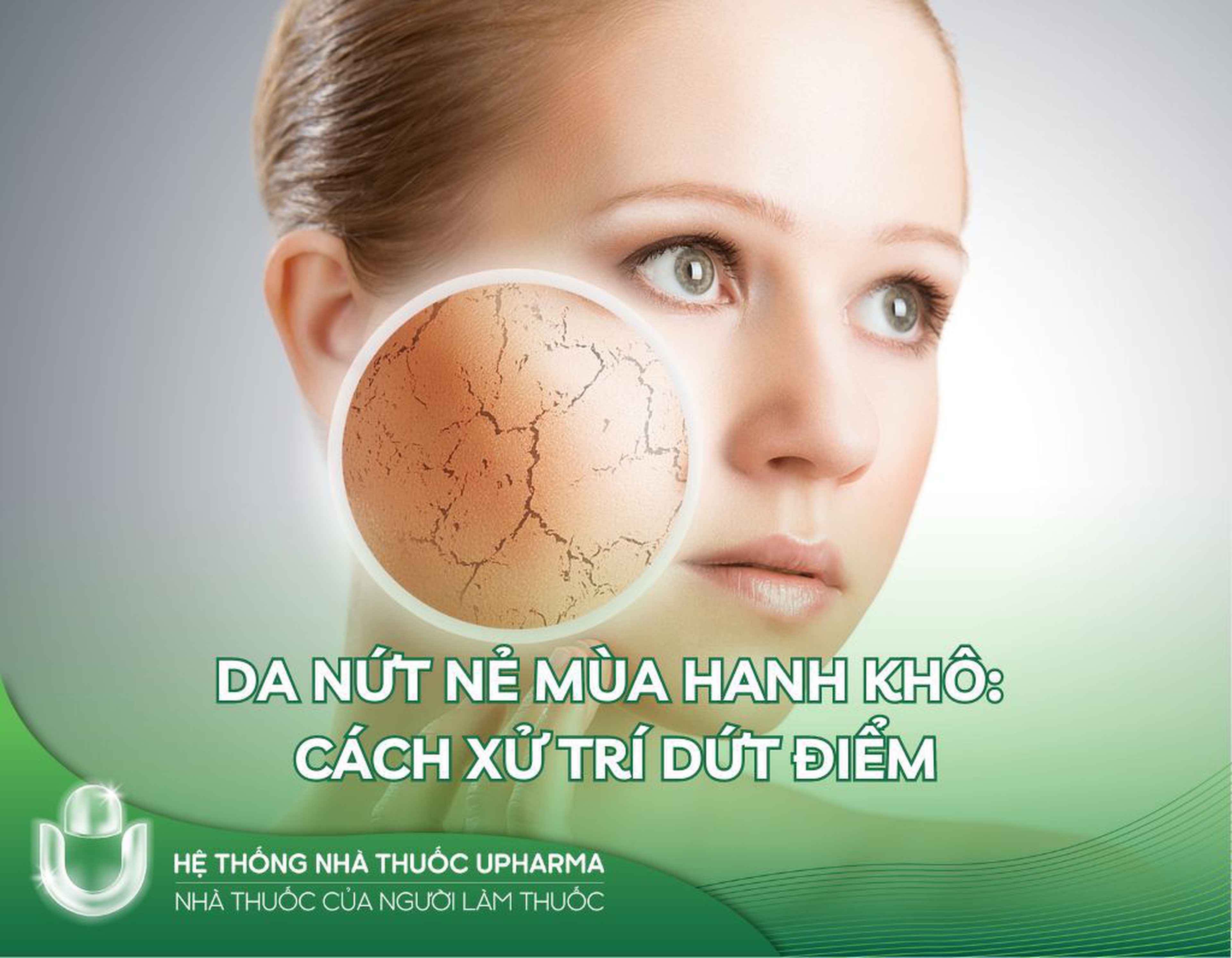 Da nứt nẻ mùa hanh khô: Cách xử trí dứt điểm