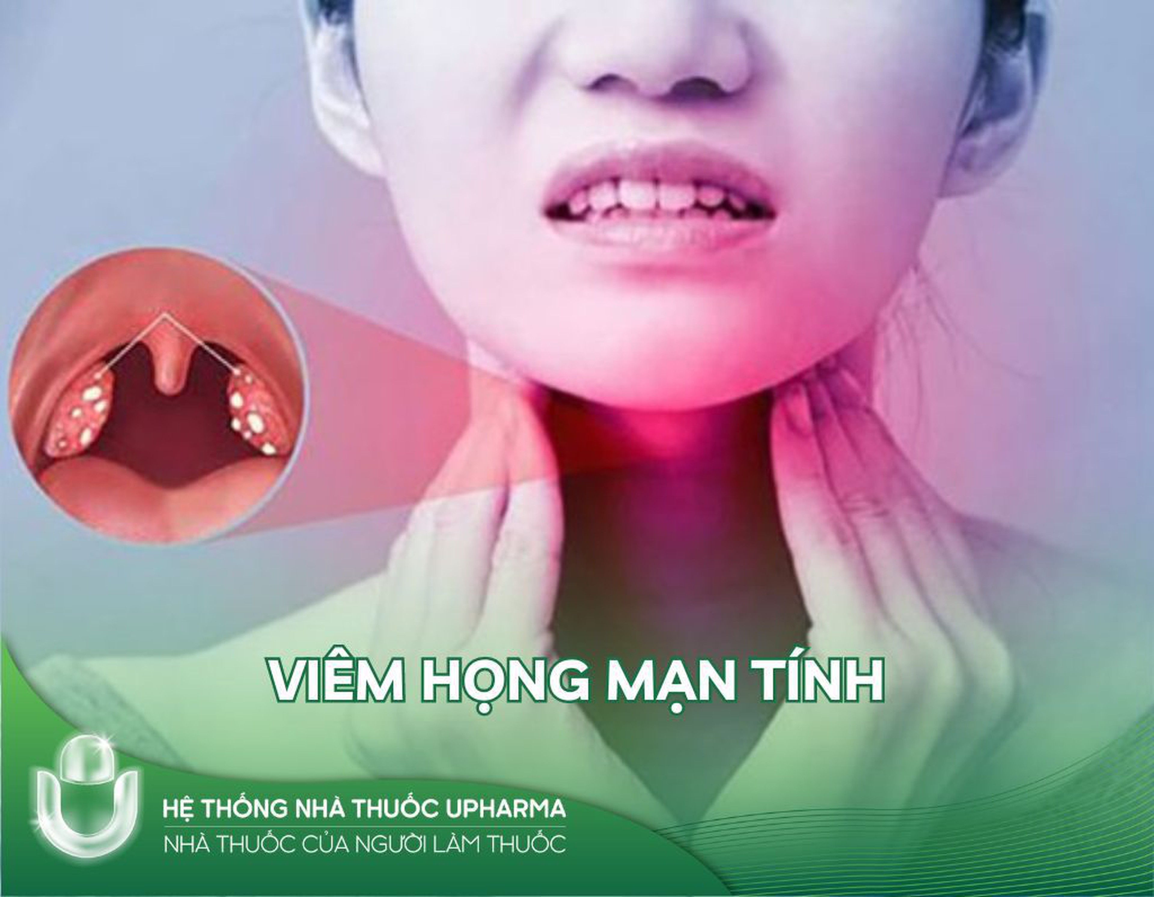Viêm họng mạn tính và những điều cần biết