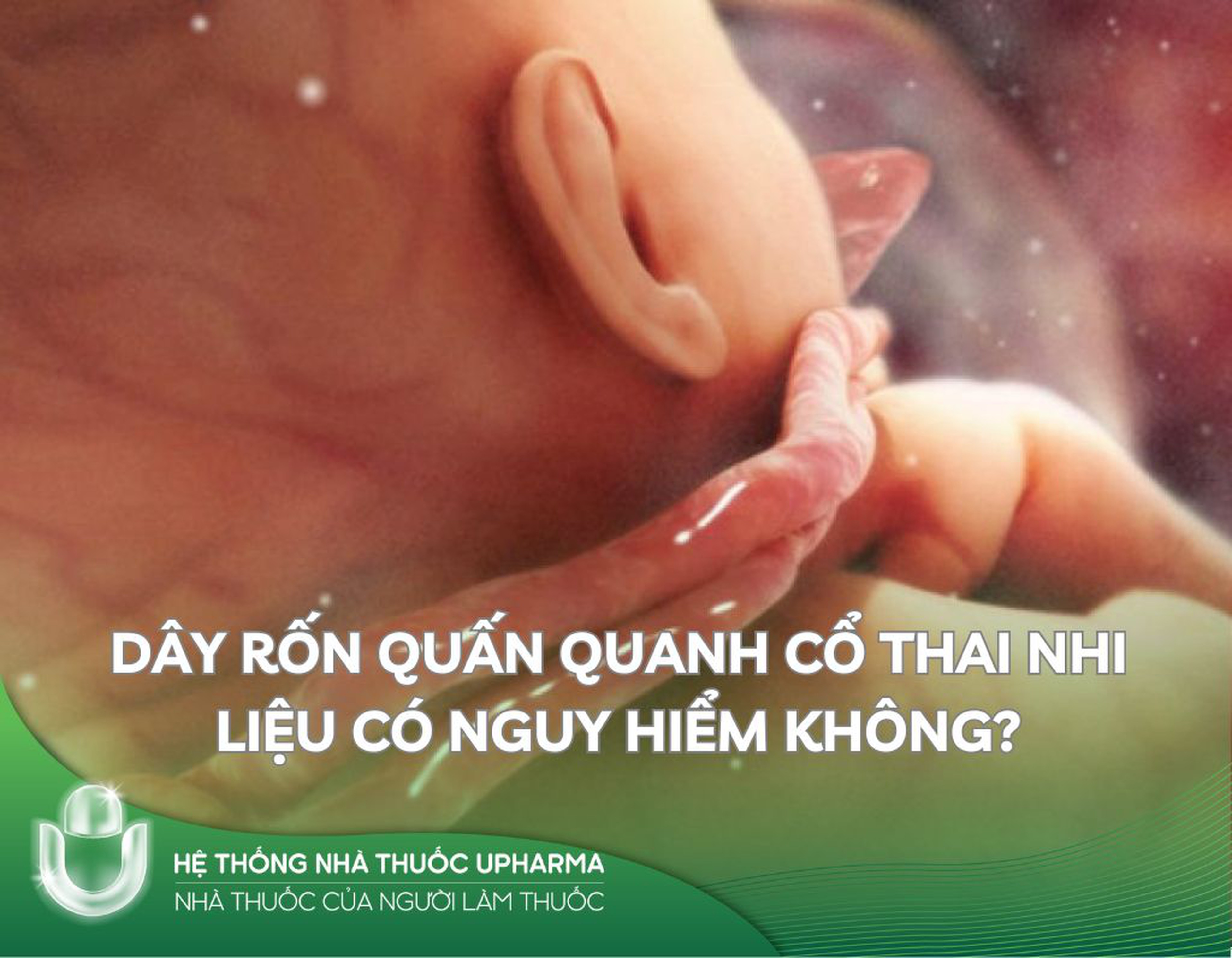 Dây rốn quấn cổ thai nhi liệu có nguy hiểm không?
