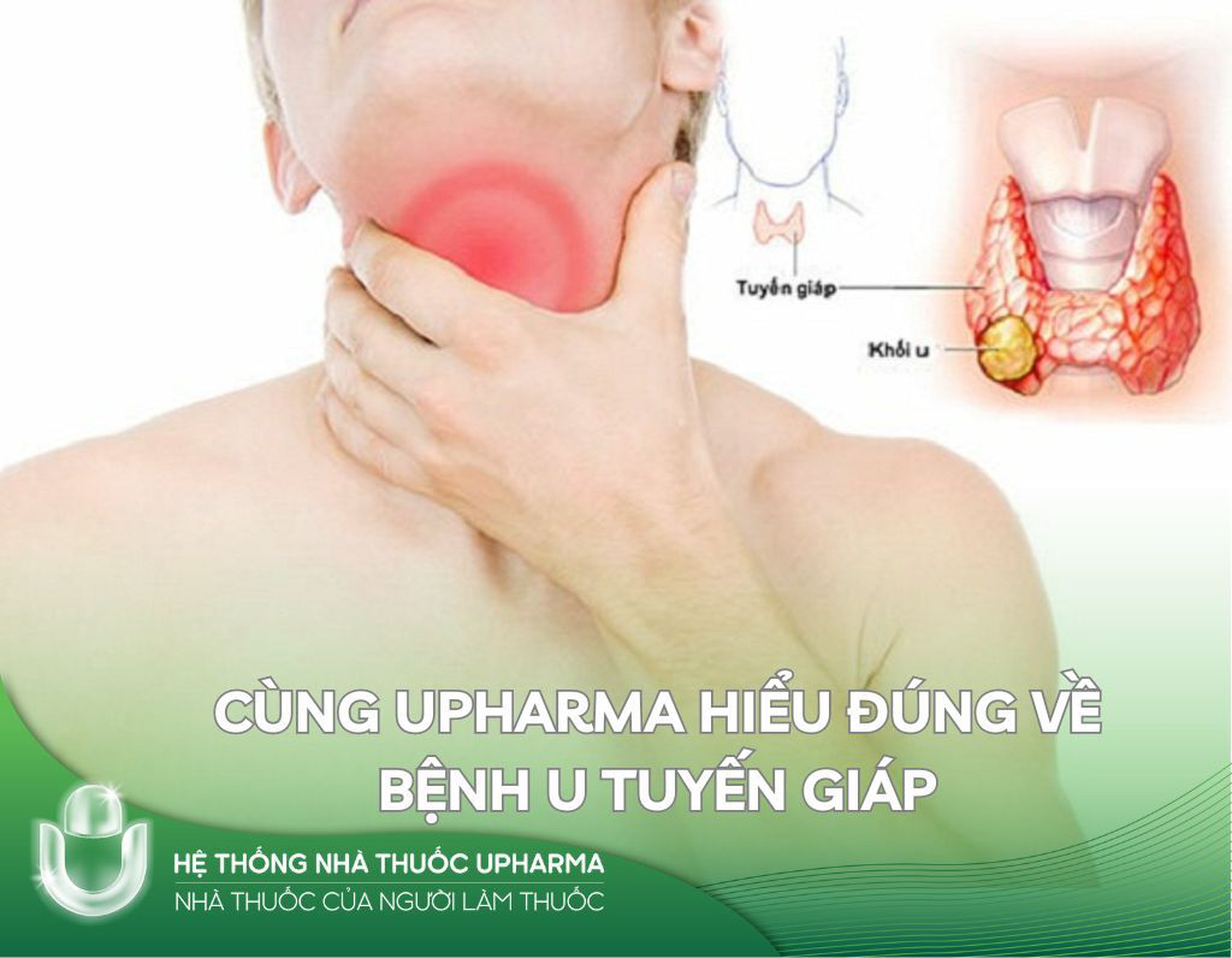 Cùng Upharma hiểu đúng về bệnh U tuyến giáp