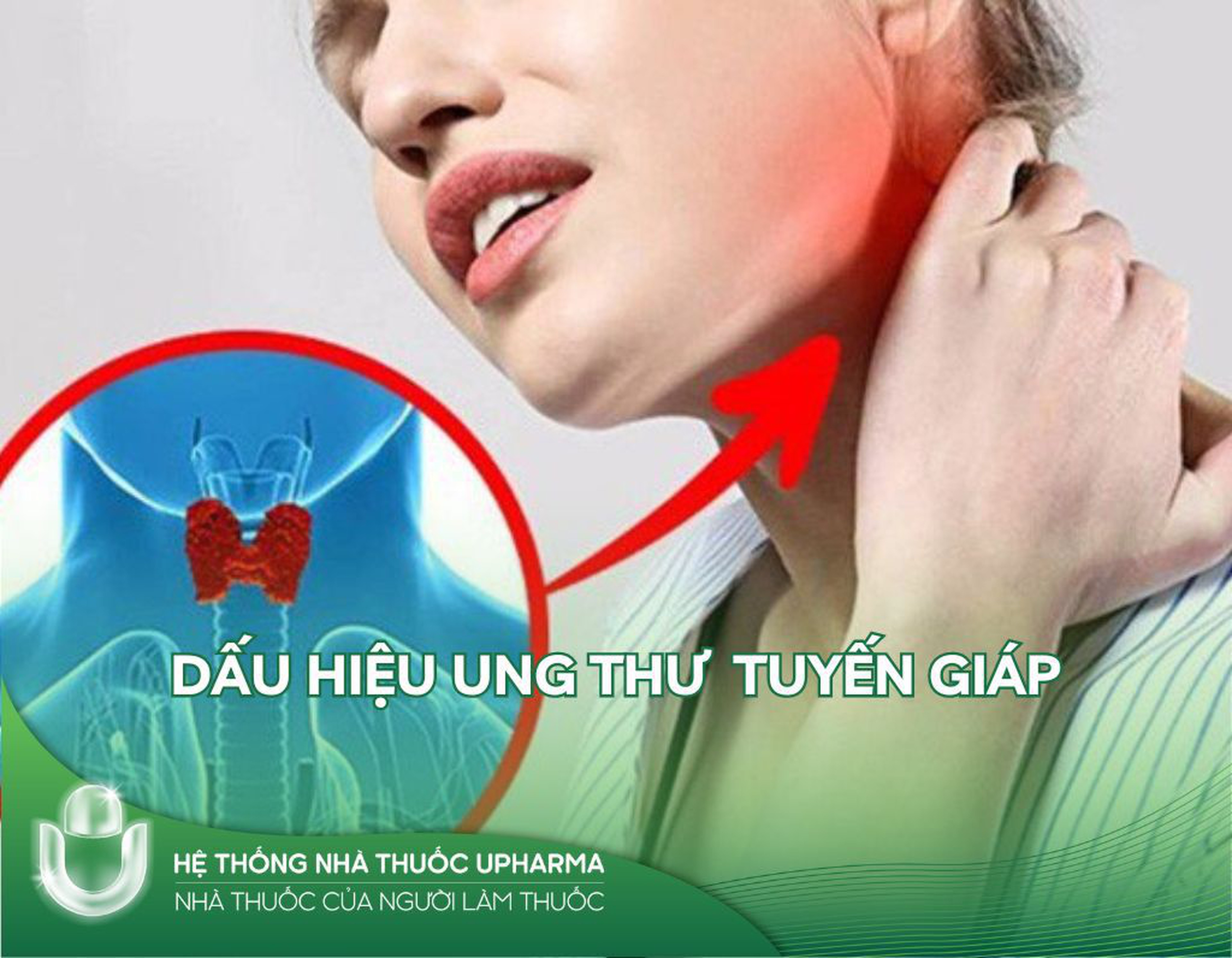 Cảnh giác ngay với 5 dấu hiệu ung thư tuyến giáp