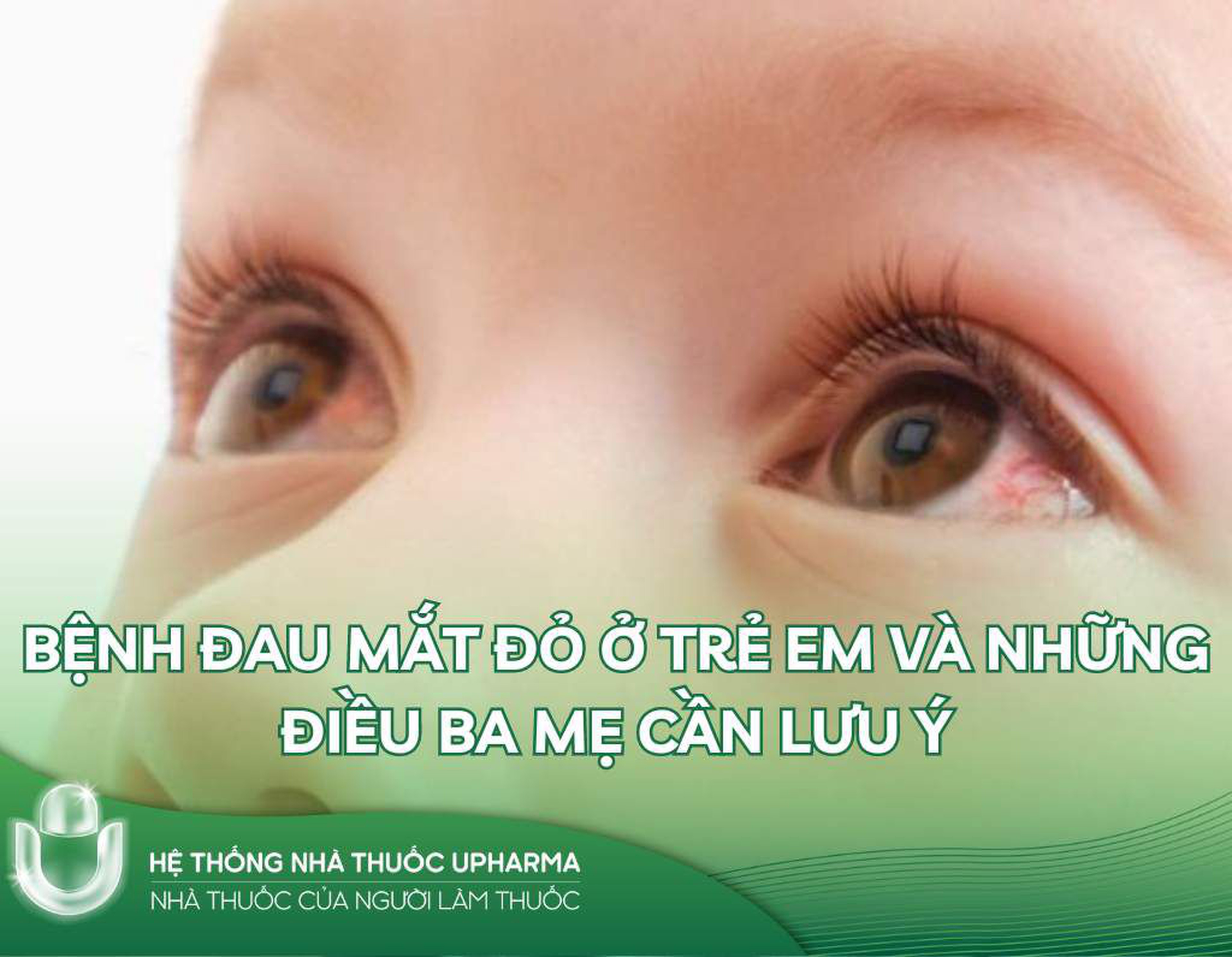 Bệnh đau mắt đỏ ở trẻ em và những điều ba mẹ cần lưu ý