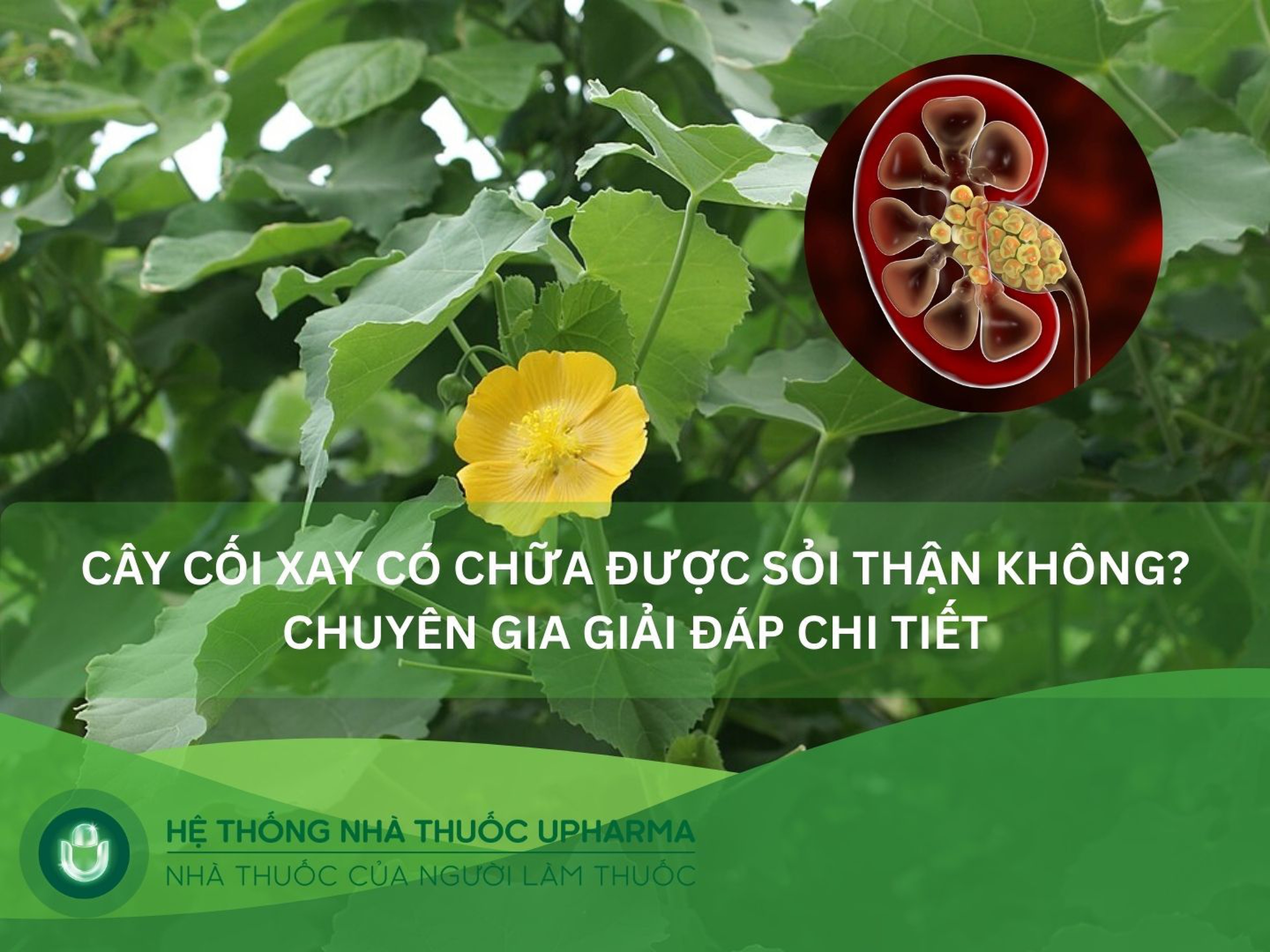 Cây cối xay có chữa được sỏi thận không? Cách dùng phổ biến