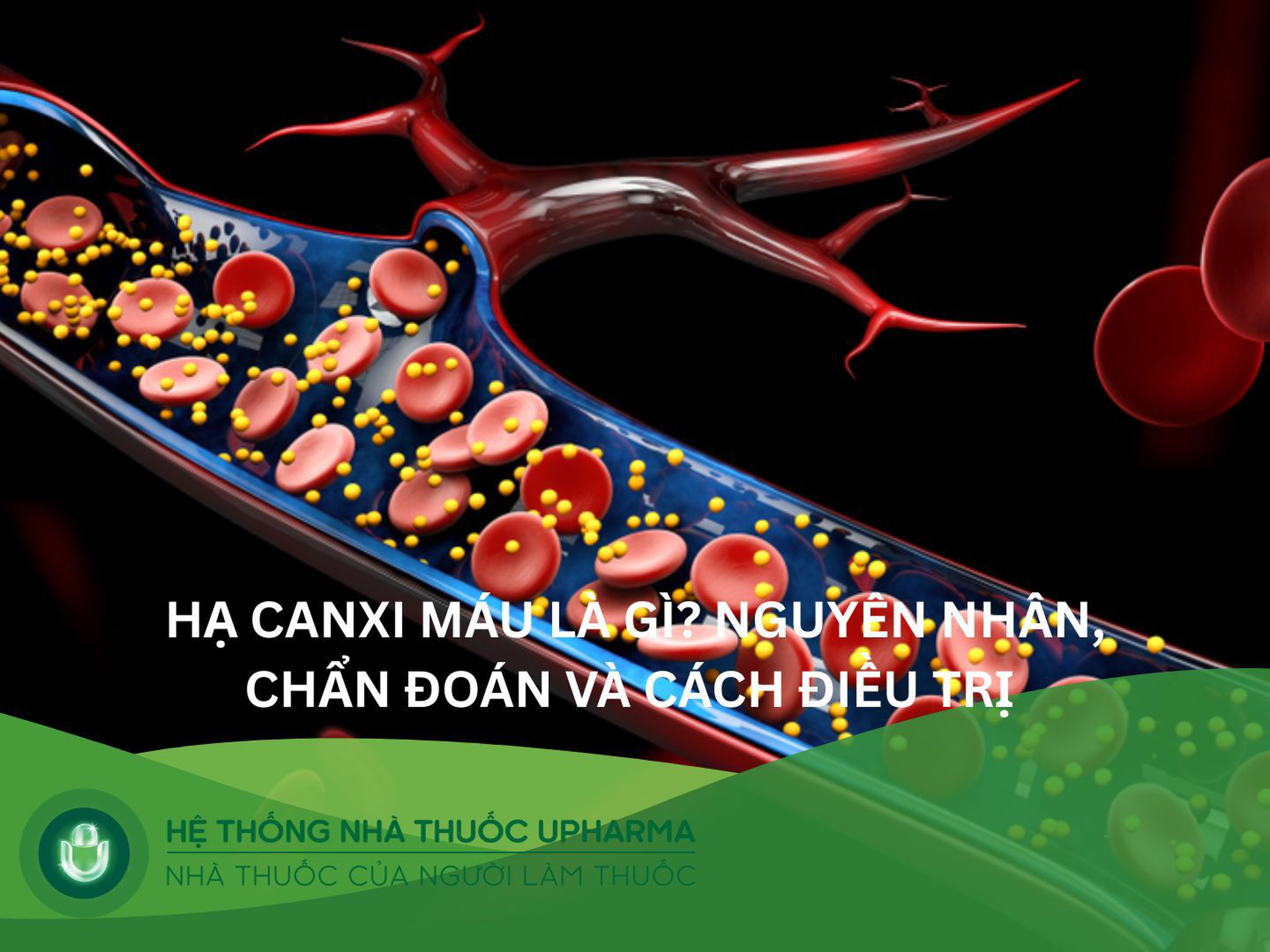 Hạ canxi máu là gì? Nguyên nhân, chẩn đoán và cách điều trị 