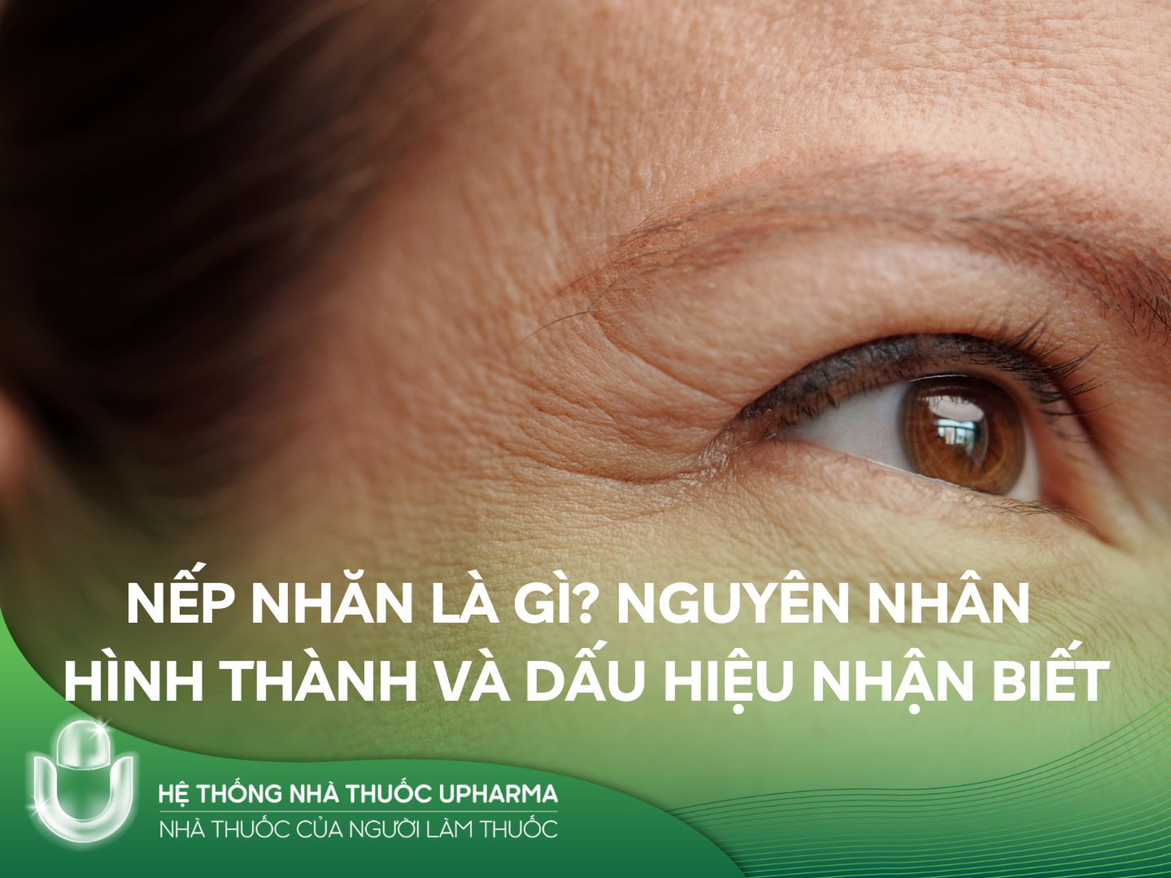 Nếp nhăn là gì? Nguyên nhân hình thành và dấu hiệu nhận biết
