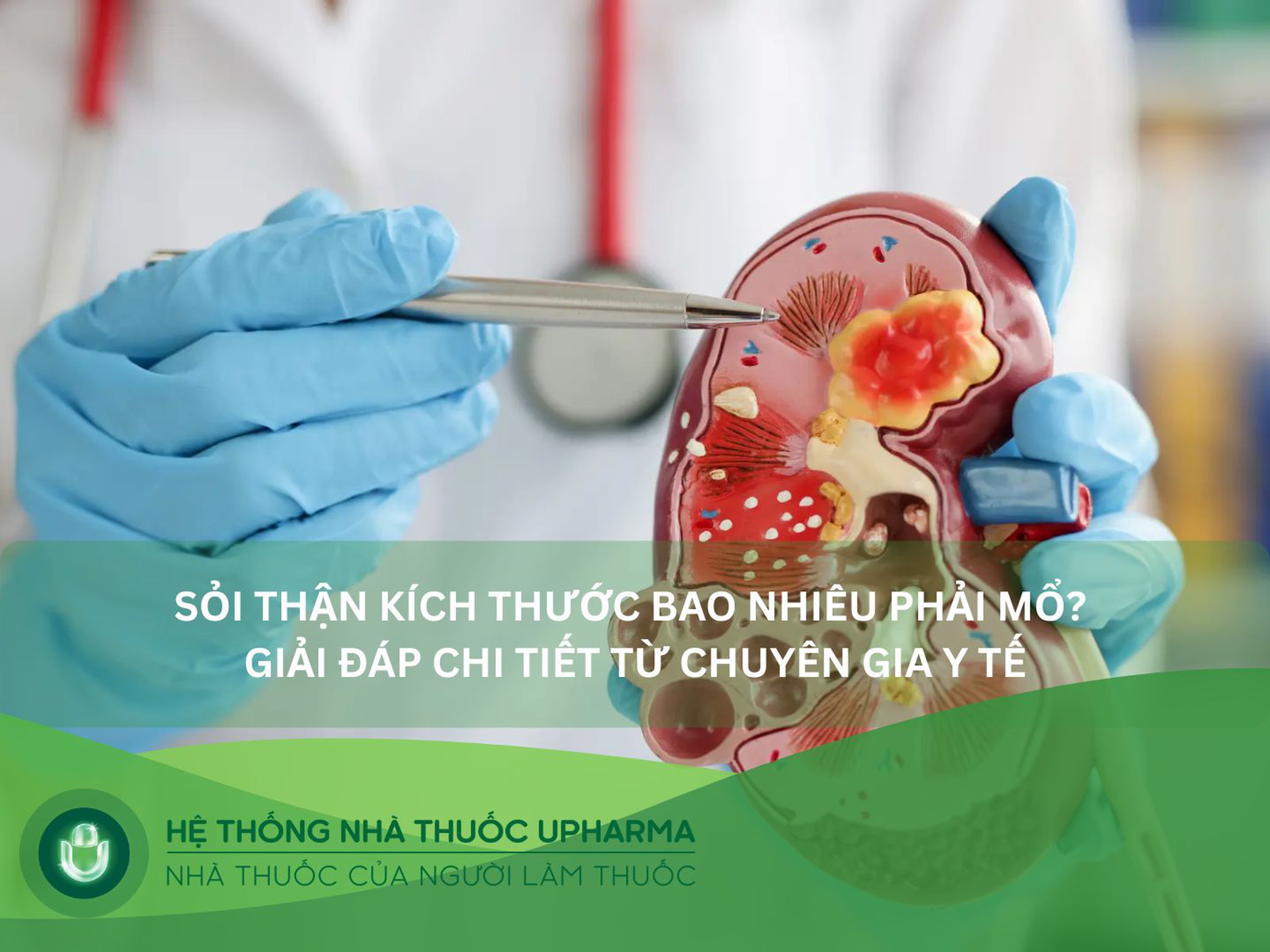 Sỏi thận kích thước bao nhiêu phải mổ để tránh biến chứng suy thận nặng?