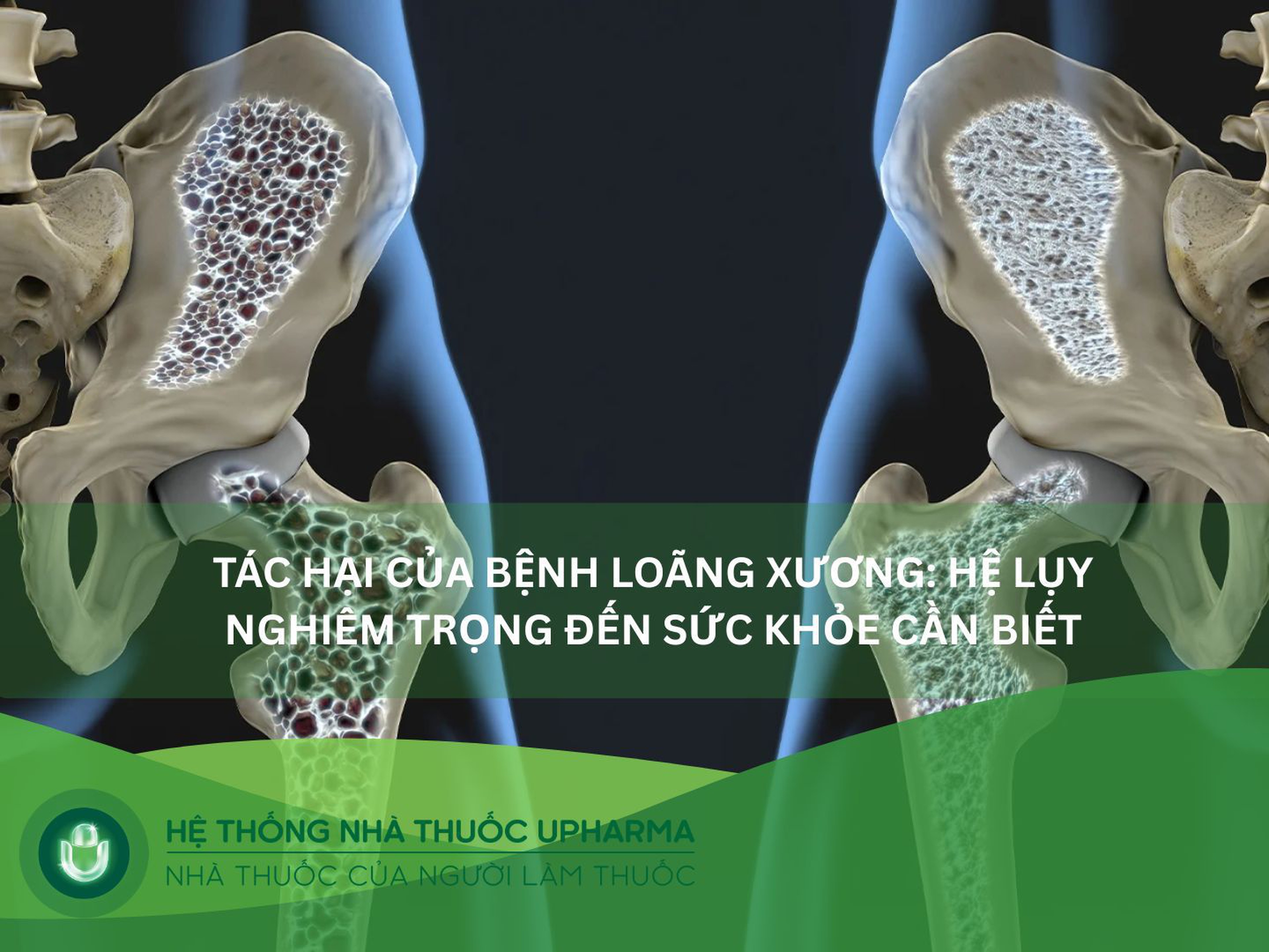 Tác hại của bệnh loãng xương: Hệ lụy nghiêm trọng đến sức khỏe cần biết