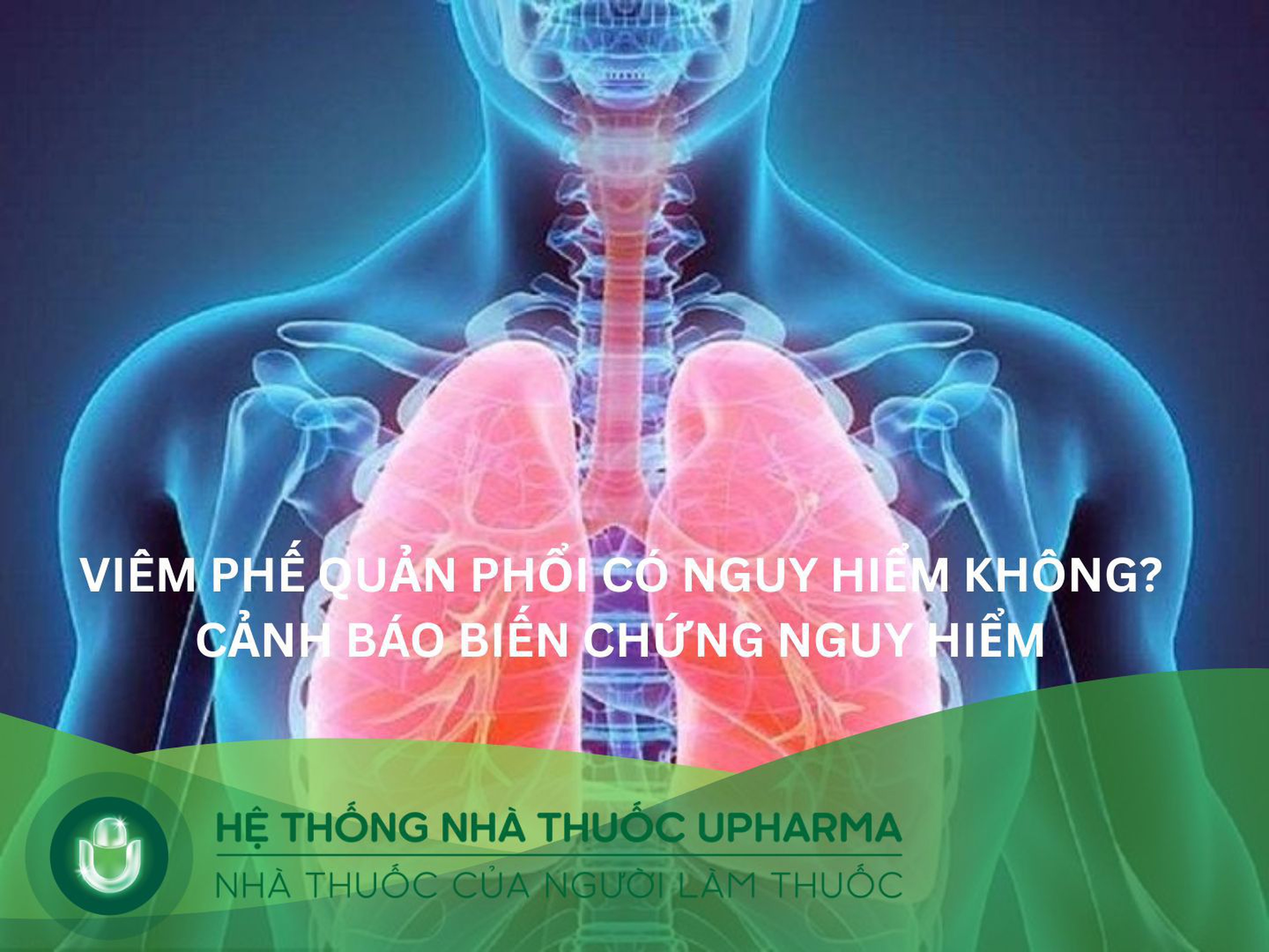 Viêm phế quản phổi có nguy hiểm không? Dấu hiệu, biến chứng cần biết