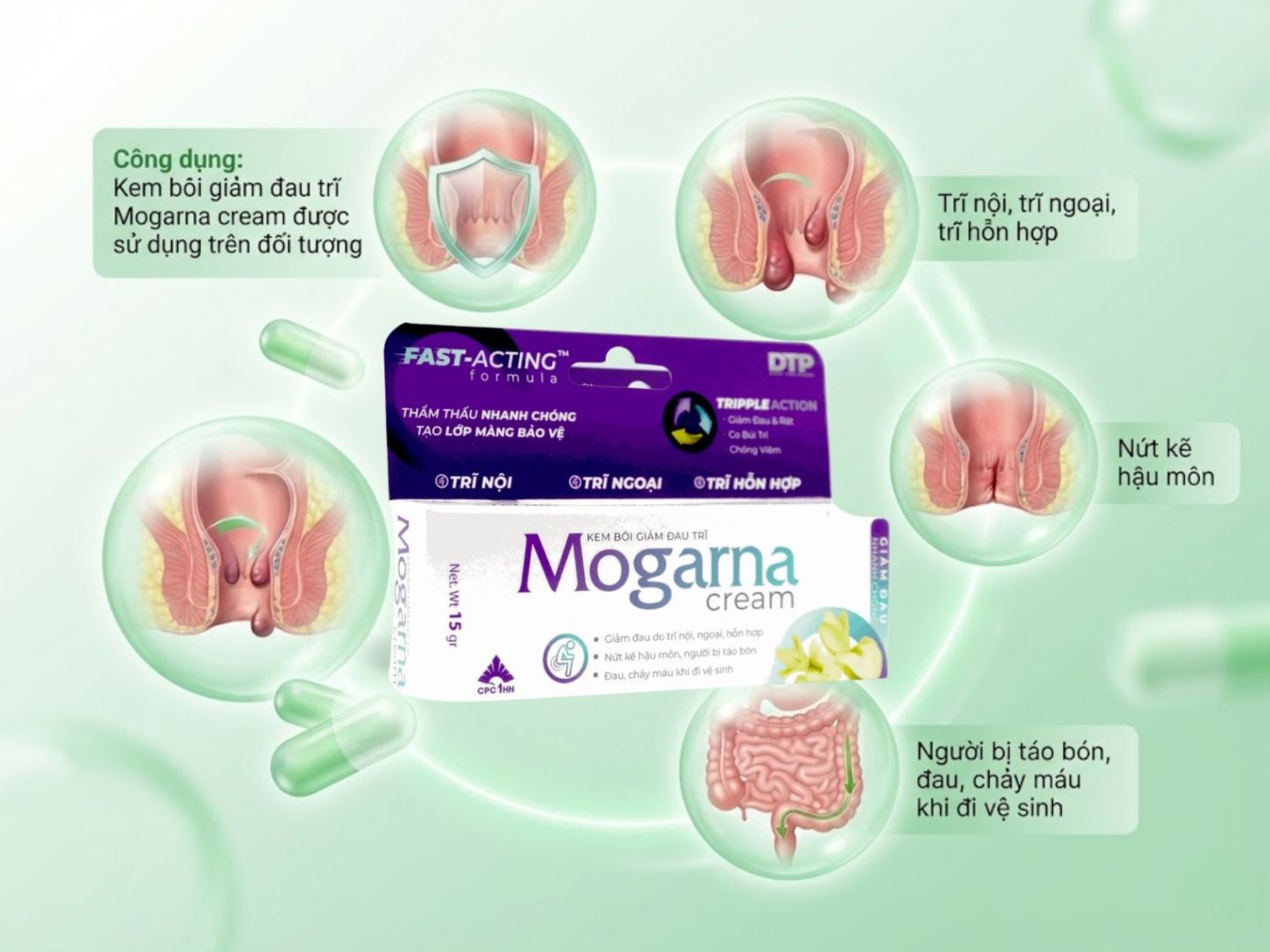 Kem bôi Mogarna cream hỗ trợ giảm đau trong bệnh trĩ (Tuýp 15g)