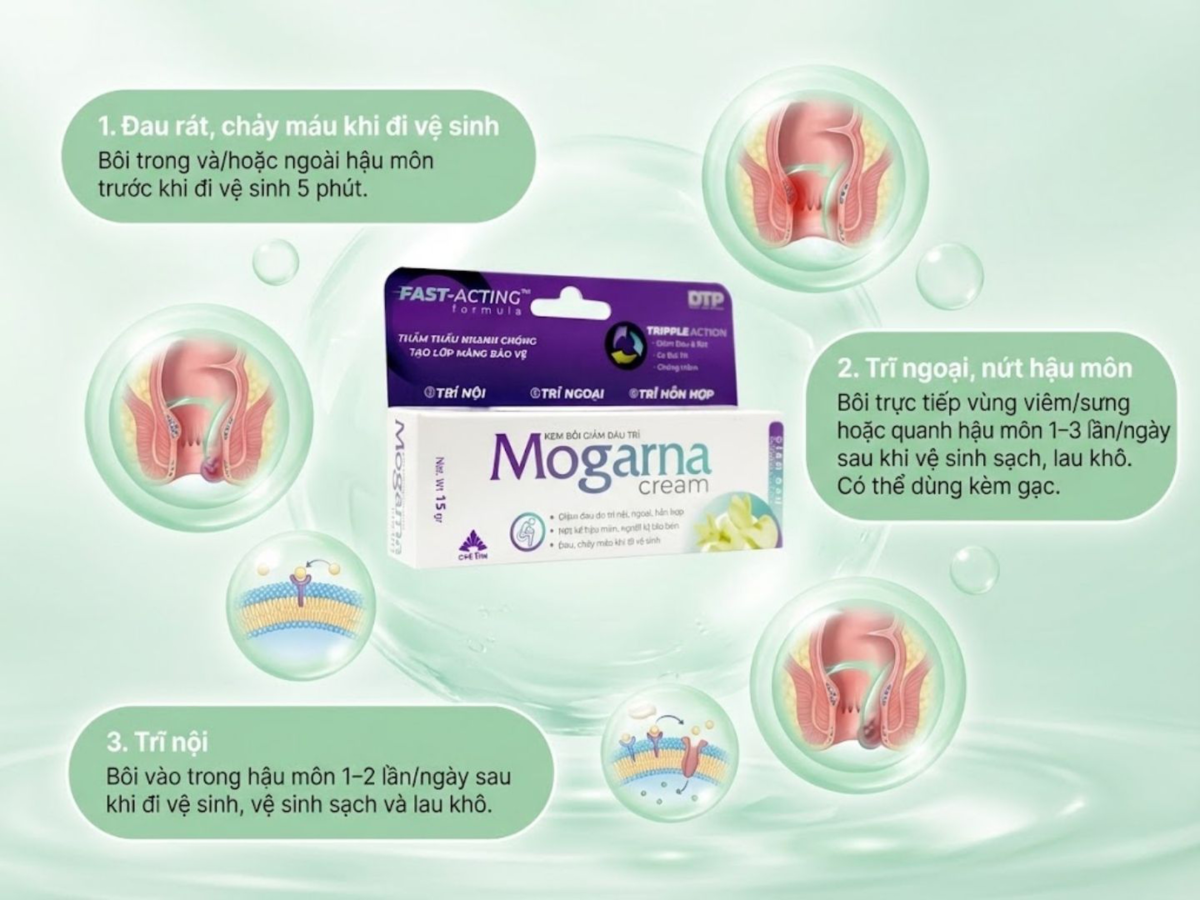 Kem bôi Mogarna cream hỗ trợ giảm đau trong bệnh trĩ (Tuýp 15g)