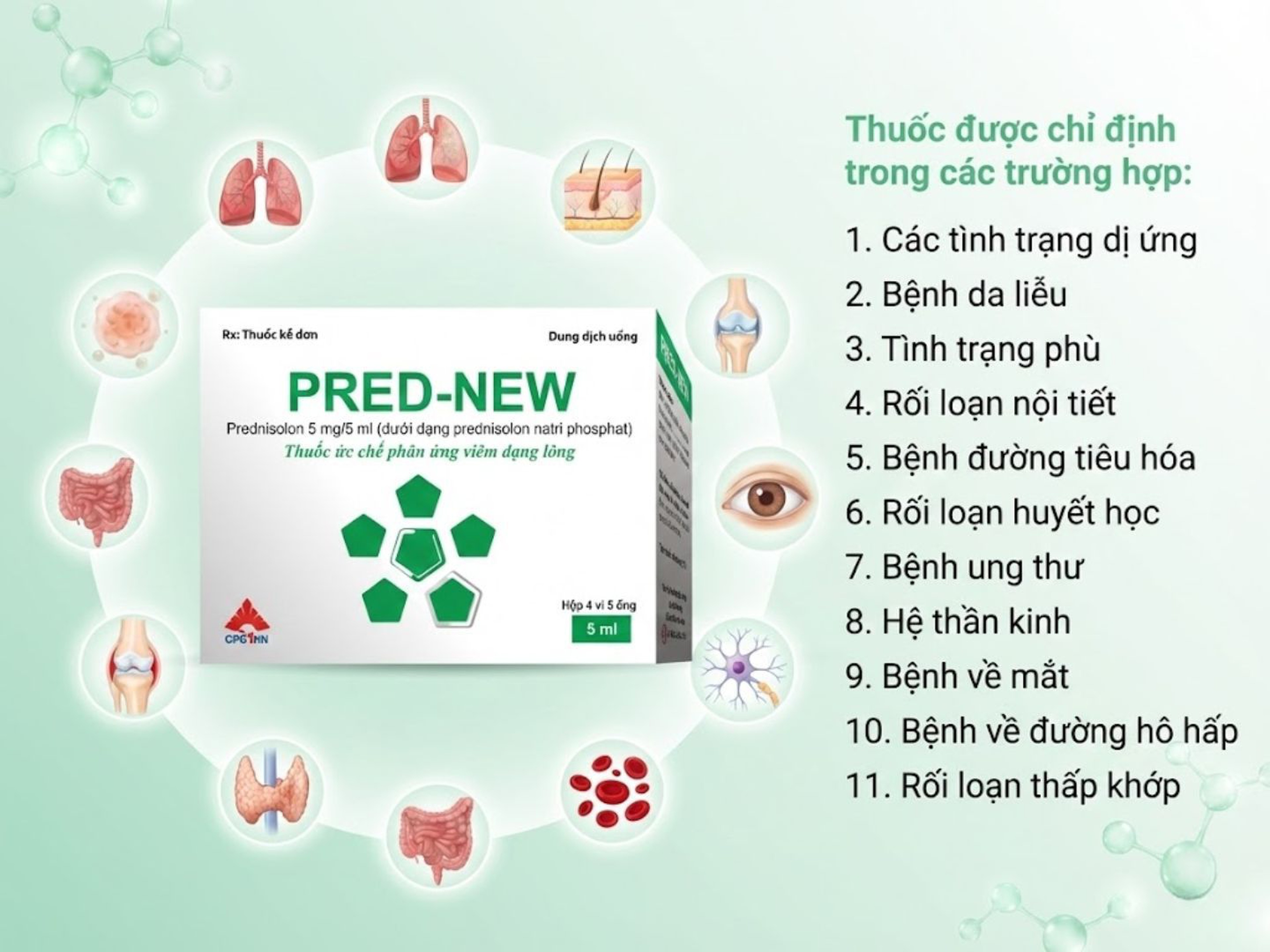 Thuốc Pred-New Sol 5mg/5ml chống viêm, chống dị ứng (Hộp 4 vỉ x 5 ống)