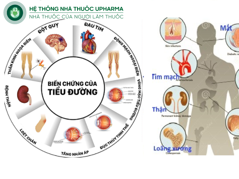 biến chứng bệnh tiểu đường
