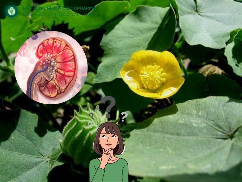 cây cối xay có chữa được sỏi thận không