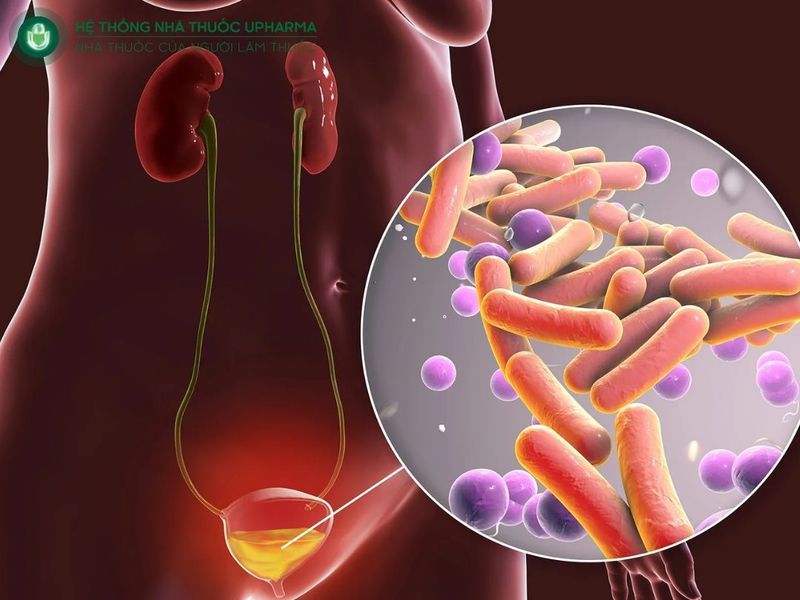 tác dụng của cây cối xay chữa sỏi thận