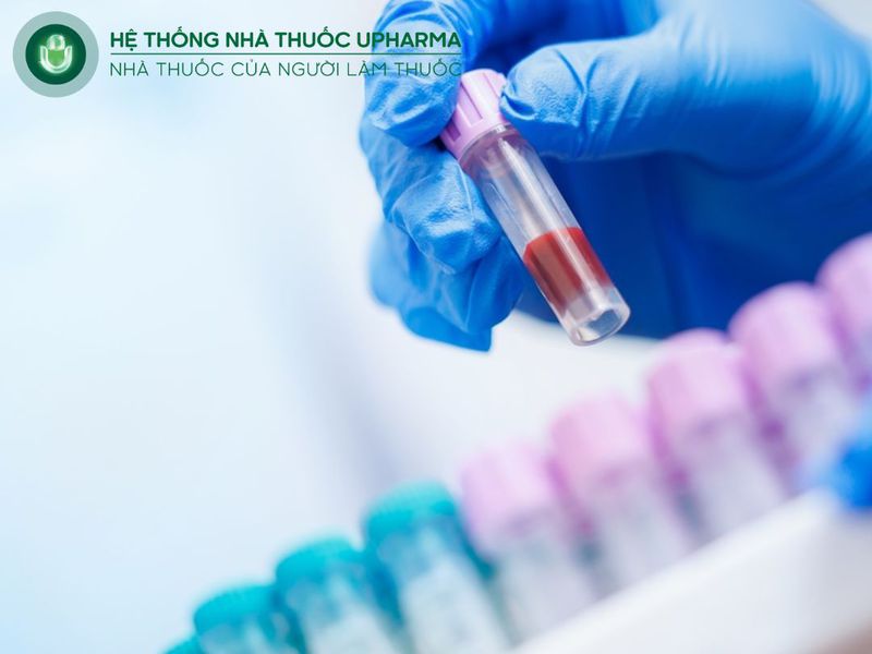 phương pháp chẩn đoán hạ canxi máu