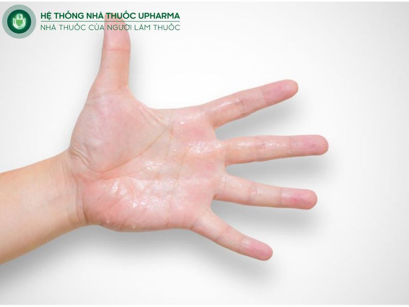 Hội chứng tăng tiết mồ hôi