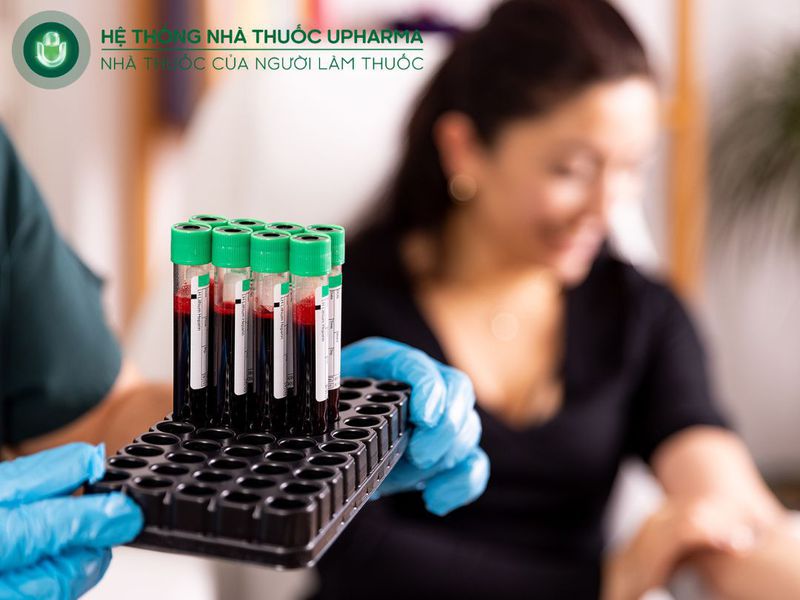 kiểm tra thiếu canxi bằng xét nghiệm lâm sàng