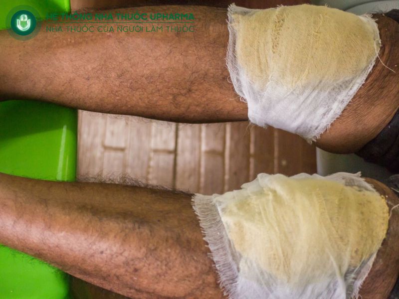 lá đắp đau xương khớp