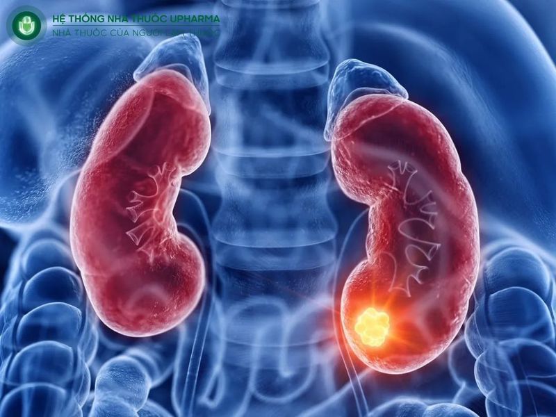 suy thận giai đoạn 1 sống được bao lâu