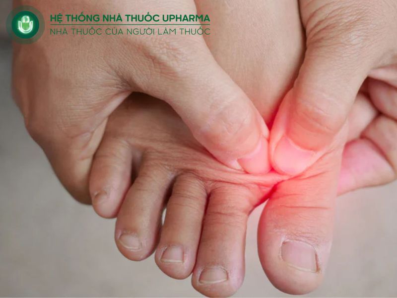 tê bì tay chân là triệu chứng thiếu canxi ở phụ nữ