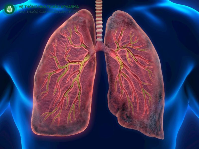 phân loại viêm phế quản