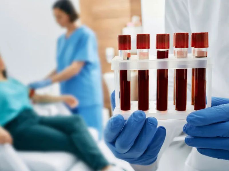 xét nghiệm máu
